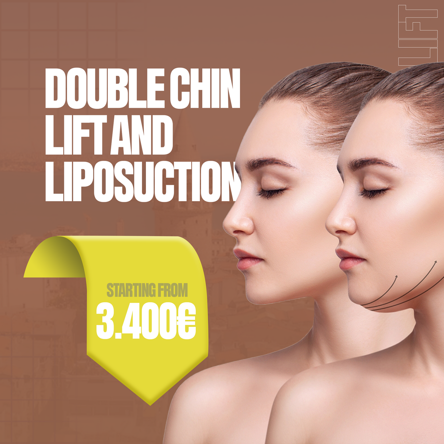 Lifting dublu barbie și liposucție
