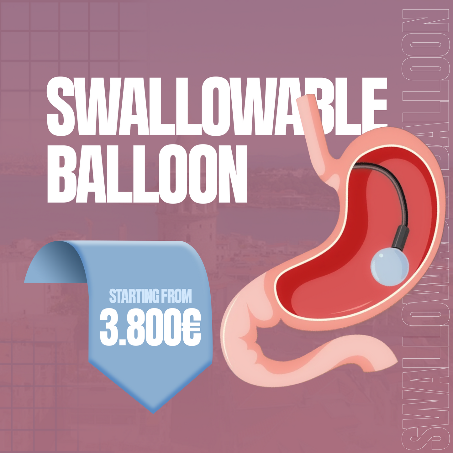 Swallowable Balloon (Allurion)